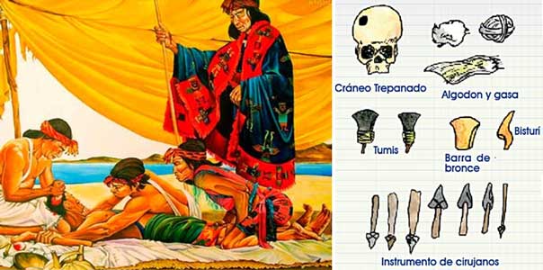 Izquierda: Trepanación craneana. | Derecha: Instrumentos cirujanos, utilizados en las trepanaciones.