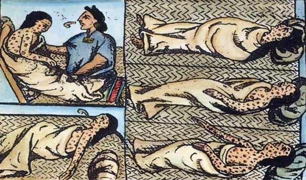 Epidemias en el Incanato: Huayna Cápac murió en Quito por viruela o sarampión, ambas enfermedades llegaron de Europa con las expediciones españolas en el Nuevo Mundo